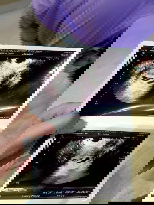 ขอประสบการแม่ๆหน่อยค่ะ