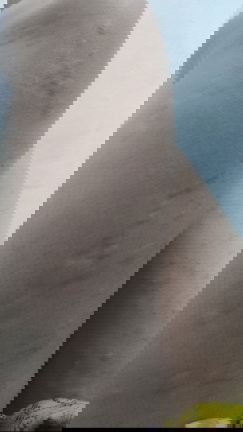 bun mau tanya... aku hamil 6 minggu badan aku gatal semua kayak biduran gtu.. disini ada yg pernah?