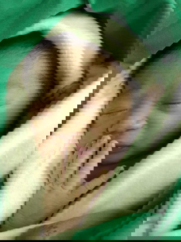 ขอวิธีกระตุ้นให้น้ำนมมาค่ะ (ผ่าคลอด)