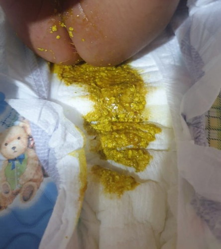poop ni baby,