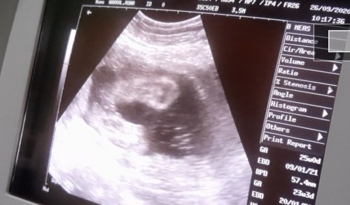 Baby Gender???