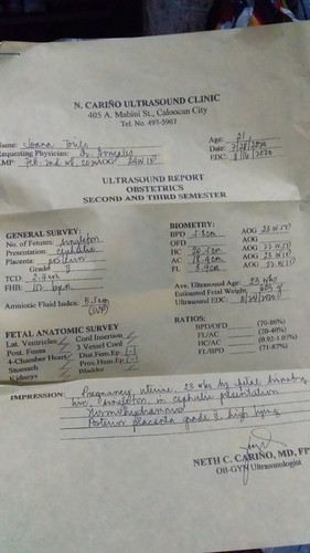 about may ultrasound