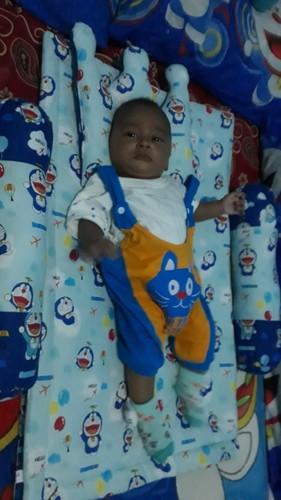 sedikit mau cerita tentang bayi sungsangku