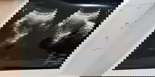 Terimakasih untuk 6 minggu 6 harinya nak 😊