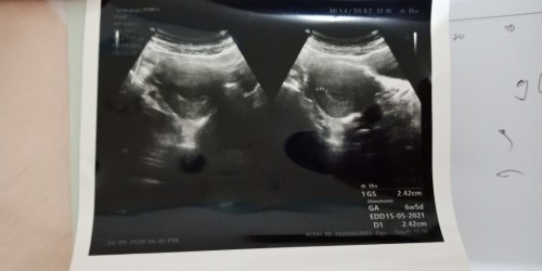 Terimakasih untuk 6 minggu 6 harinya nak 😊