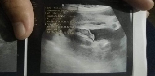 26w ของแม่ๆเพศไหนกันบ้างค่ะ