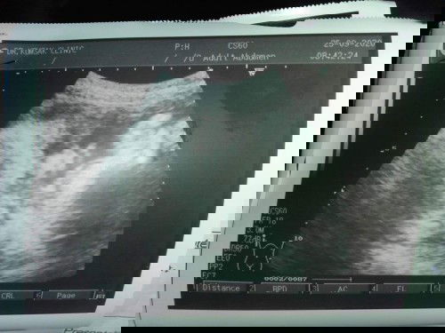 ช่วยดูเพศน้องไห้หน่อย