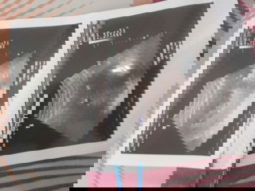 Assalamualaikum bunda mau tanya kalo bayi kembar itu apakah satu kantong atau beda kantong