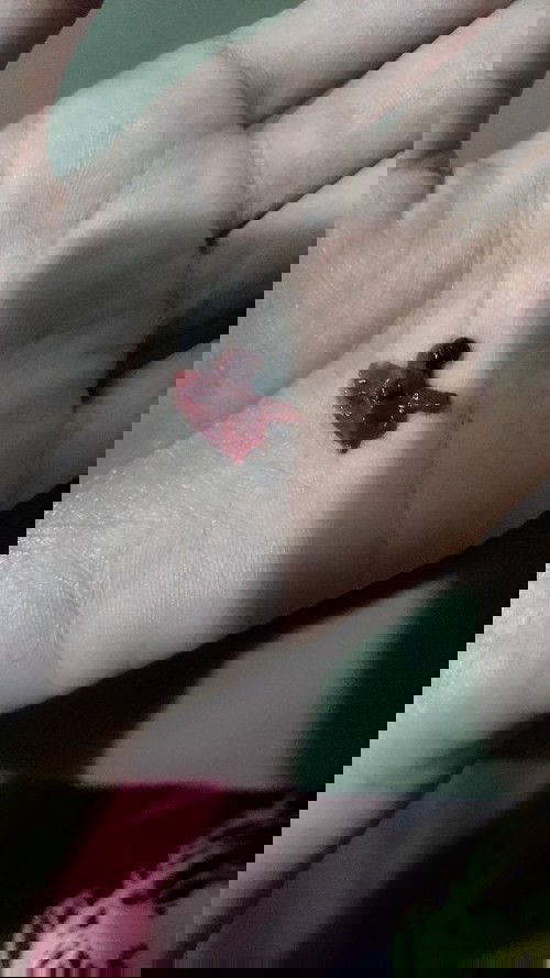 แบบนี้คืออะไรคะ ?