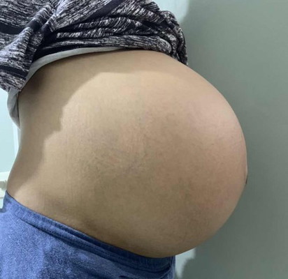 37 weeks pregnant