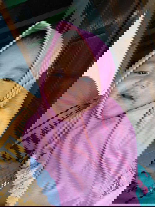 ruam pipi merah2 setelah mandi