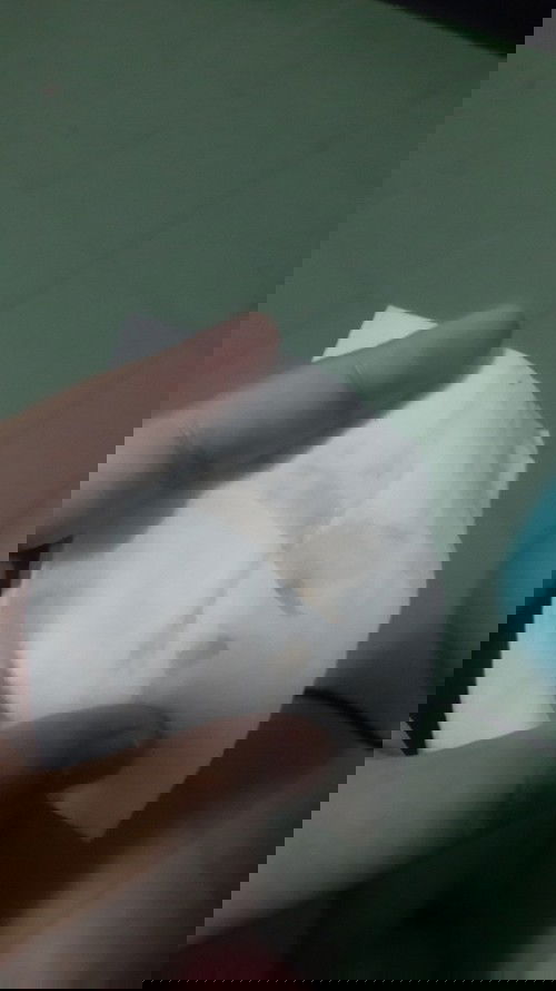 มีคุณแม่คนไหนบ้างที่มีเลือดออกเป็นสีน้ำตาลไม