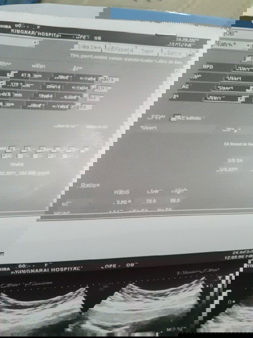 หมอไม่แจ้งน้ำหนักลูกค่ะ