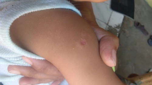 Ruamkah atau apa ya bun?