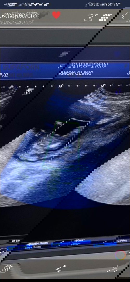 ฝากแม่ๆช่วยดูหน่อยจร้าา