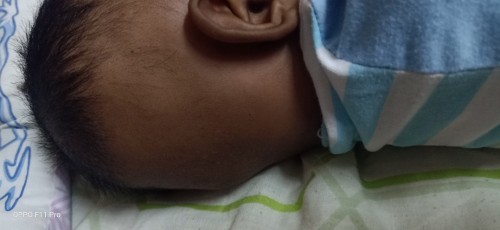 kenapa rambut baby saya macam ini?
