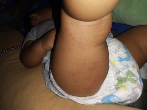 เด็กทาคาลาไมล์ได้ไหม