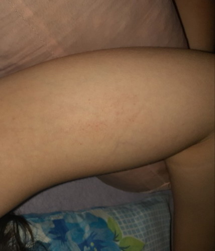 Asking for my skin