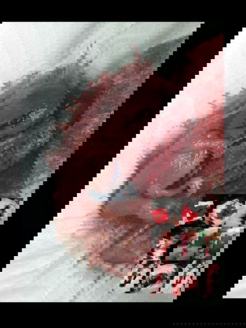 miscarriage/blighted ovum :((