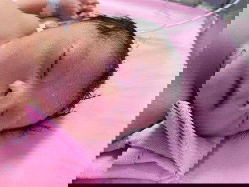 แชร์ประสบการณ์การคลอด