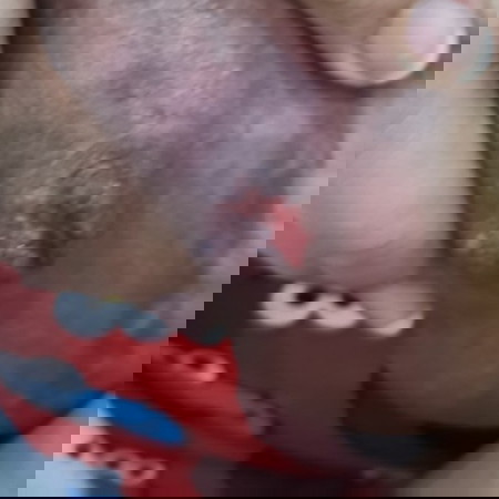 Ngsusugat ang nipple