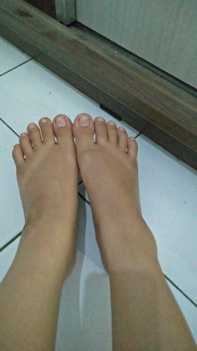 Kaki bengkak dan jari tangan kebas (seperti kesemutan) saat hamil