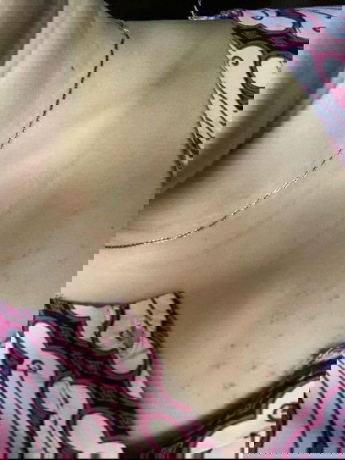 Bintik2 merah saat hamil