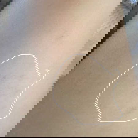 Parang Balat ng chicken