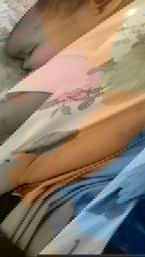 menghilangkan noda hitam belas nyamuk