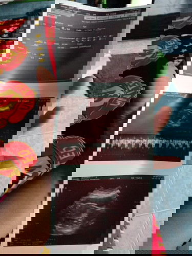 กำลังตั้งครรภ์