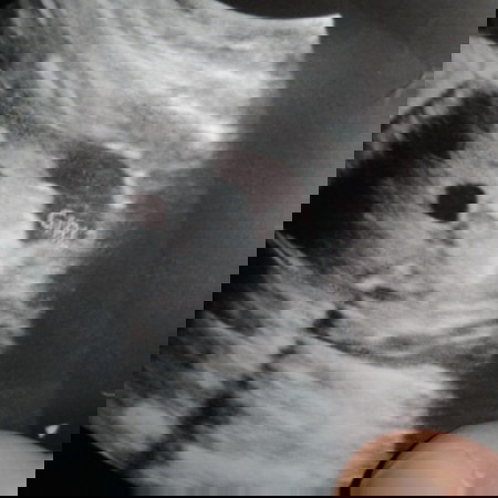 Girl din ba tingin nyo po?