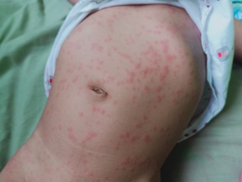 ฝื่นตามเต็ม