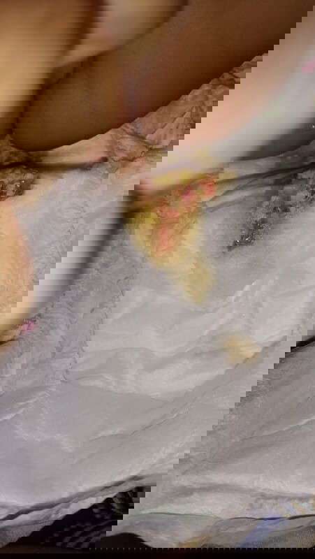 Pup berdarah dan berlendir. Bahaya apa tidak ya. bunda bunda di sini yg mungkin ngalamin sama.