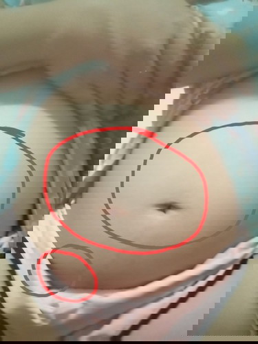 ตั้งครรภ์ได้22w5d