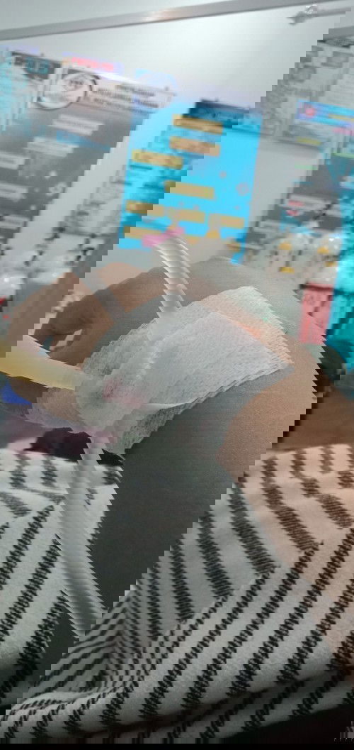 Melahirkan usia 34 minggu