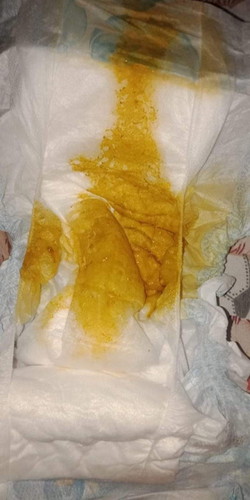 Tungkol sa pag dumi ng baby