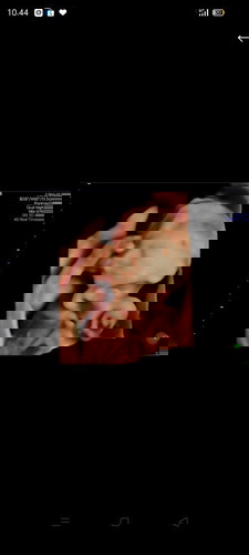 Hamil lima bulan tapi seperti melayang sempoyongan dan badan sangat letih solusi nya apa