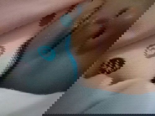 bintik putih bawah bibir