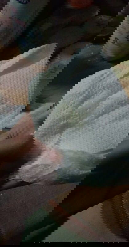 ตกขาวสีเหลืองนิดๆ