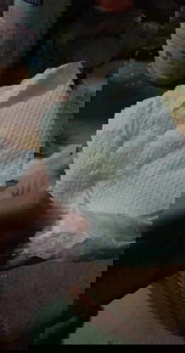 ตกขาวสีเหลืองนิดๆ