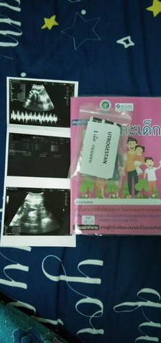 กินยาระงับการคลอดต่ออีกหน่อยนะ