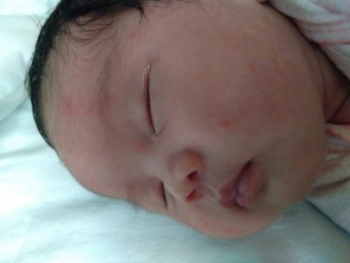 Ano kaya tong mga botlig2 sa mukha ni baby normal.lng ba to sa new born? 2weeks palang po si baby..