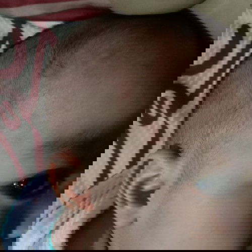 Demam hilang ruam datang