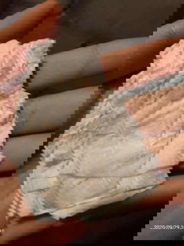 มีมูกปนเลือด