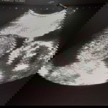 อยากได้ลูกสาวค่ะ