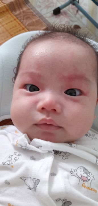 Sức khỏe cho bé