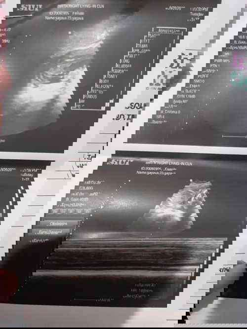 Mga mommies is it a boy or a girl?