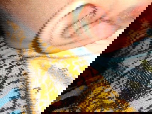 kulit sensitif mulus sehari seminggu nya kmbuh