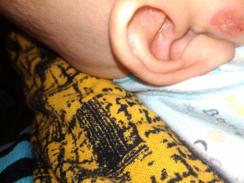 kulit sensitif mulus sehari seminggu nya kmbuh