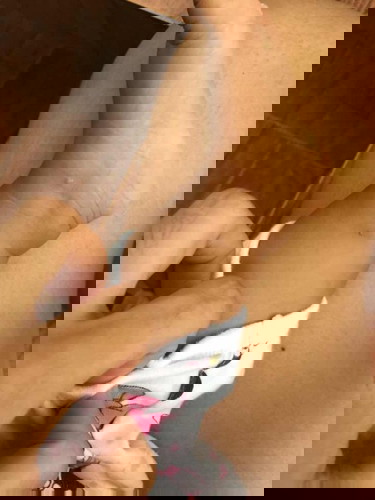 ขอแนะนำครีมหน่อย รอยดำ